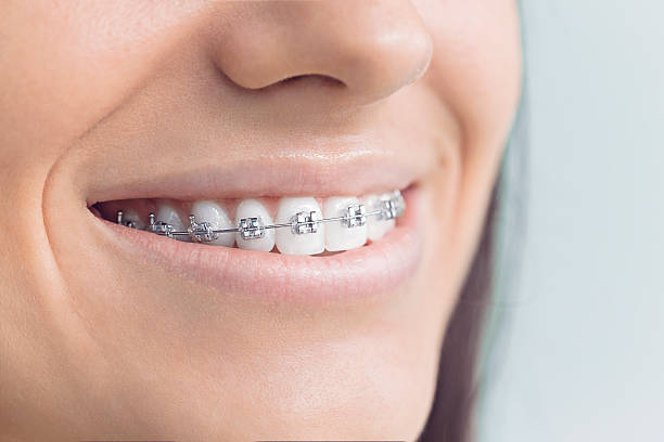 Dental Bonding in Mount Morris, IL